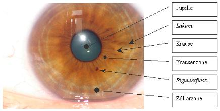 Iris-Strukturen